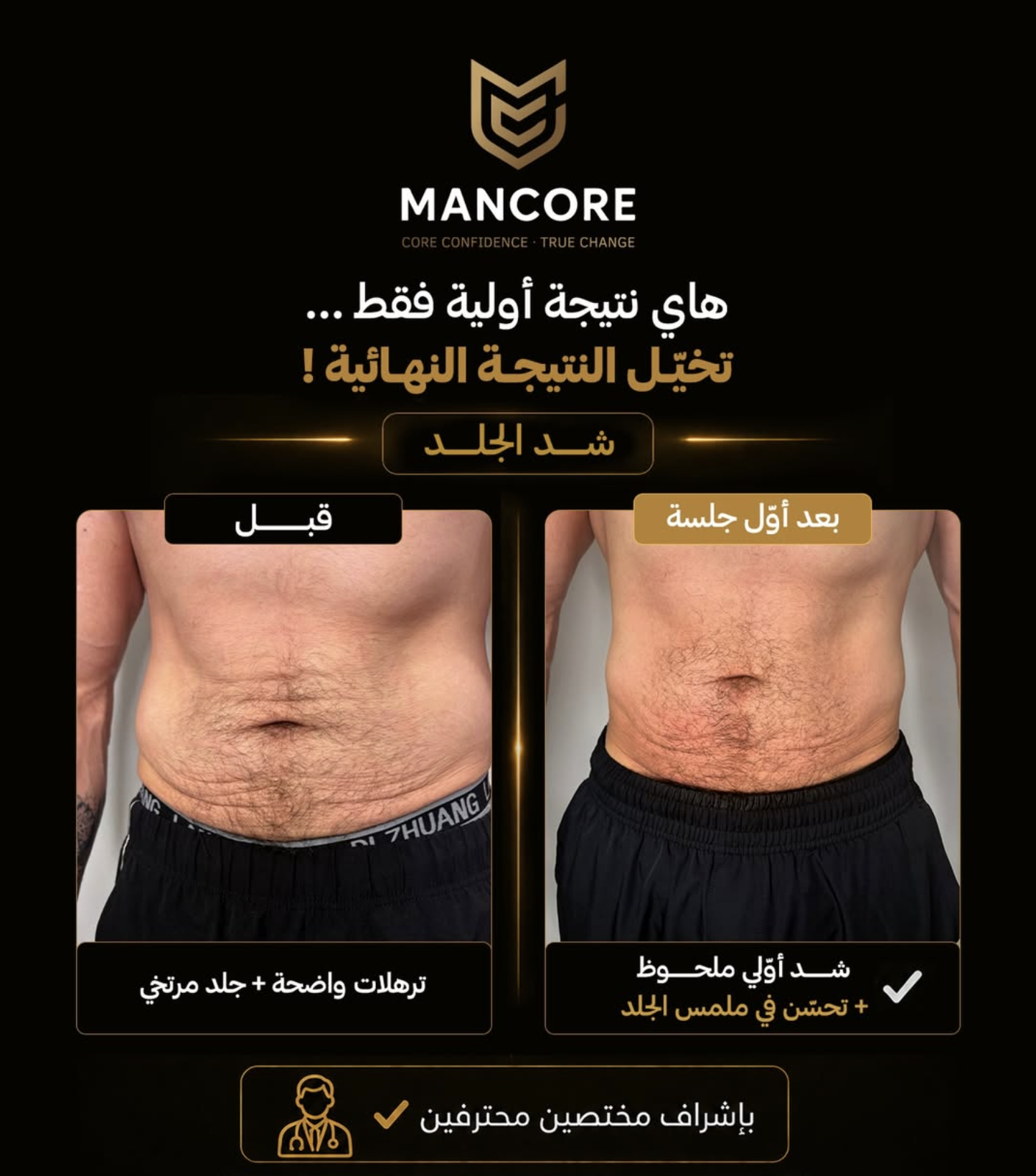 MANCORE — לפני ואחרי