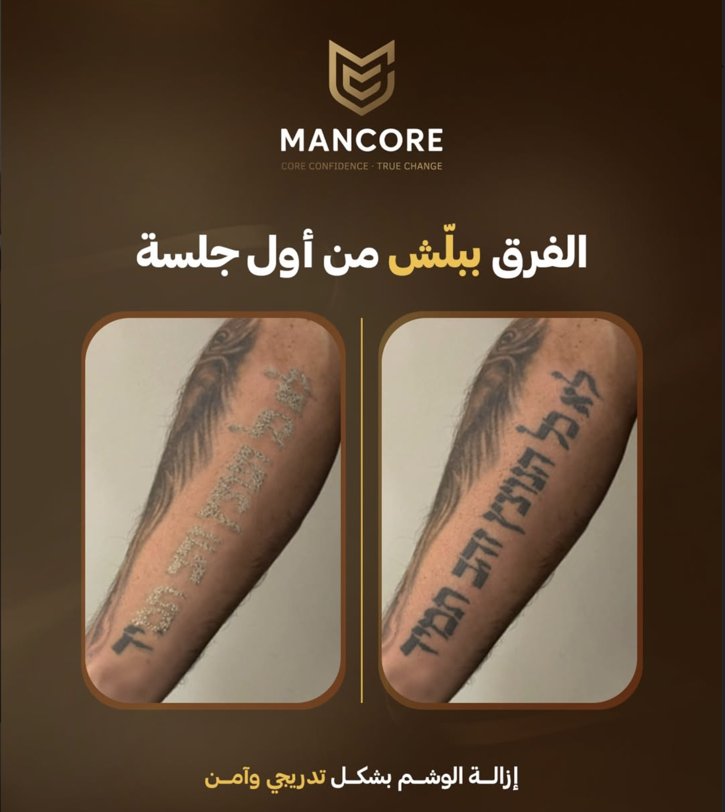 MANCORE — לפני ואחרי