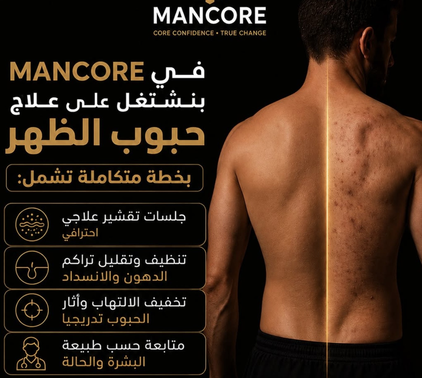 MANCORE