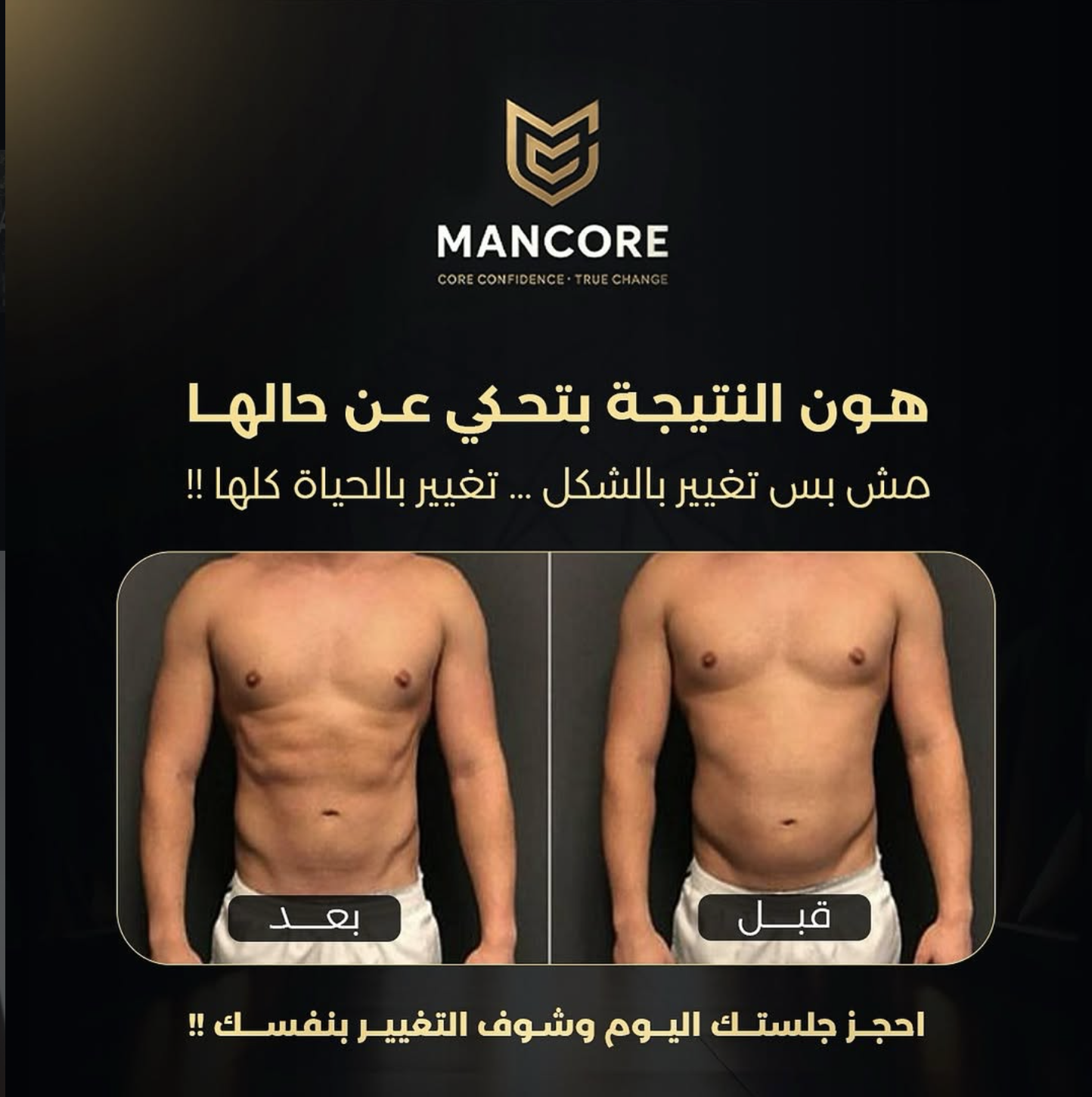 MANCORE — לפני ואחרי
